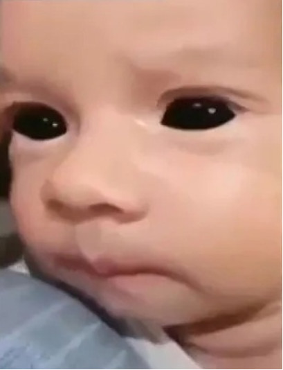 bébé yeux noir vaccin